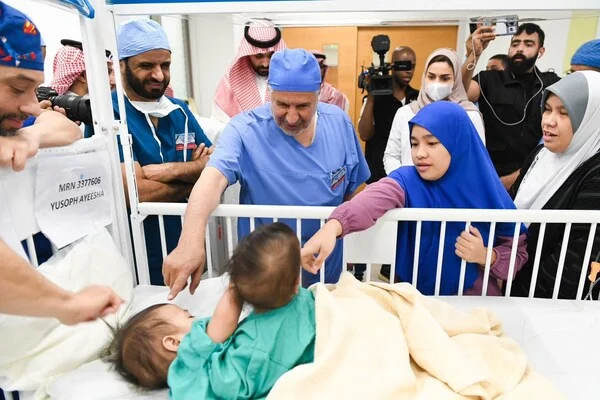 Successful Separation Surgery Gives Hope to Filipina Conjoined Twins in Riyadh