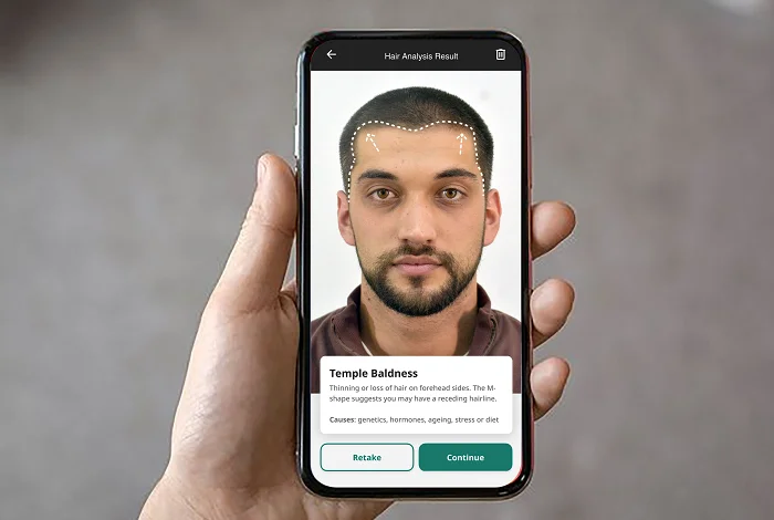 Cureskin to Launch World’s First AI-Powered Hair Analyser to Combat Baldness on 20th April 2025<br>
