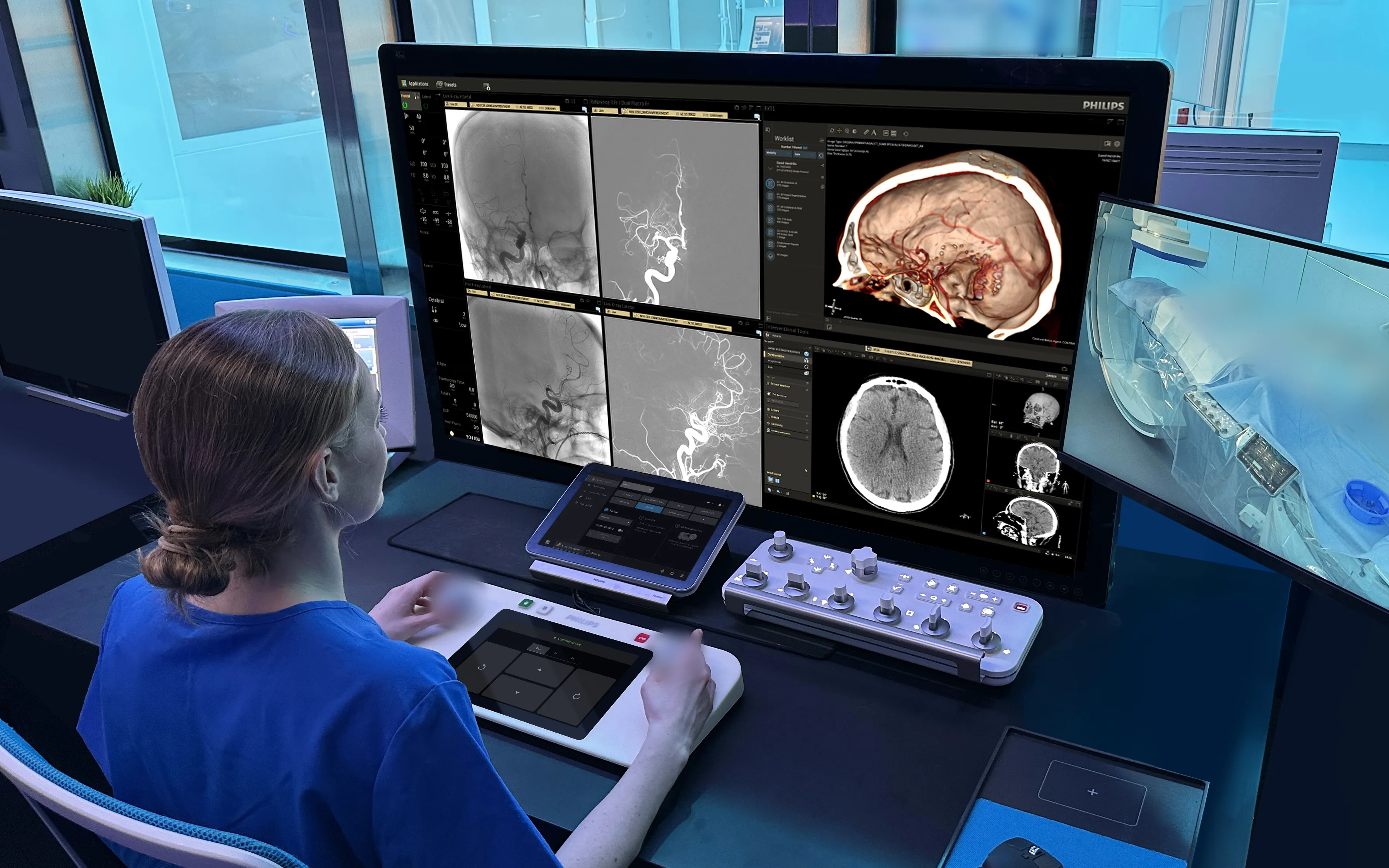 Philips selected for ARPA-H program to advance AI-enabled robotic stroke care