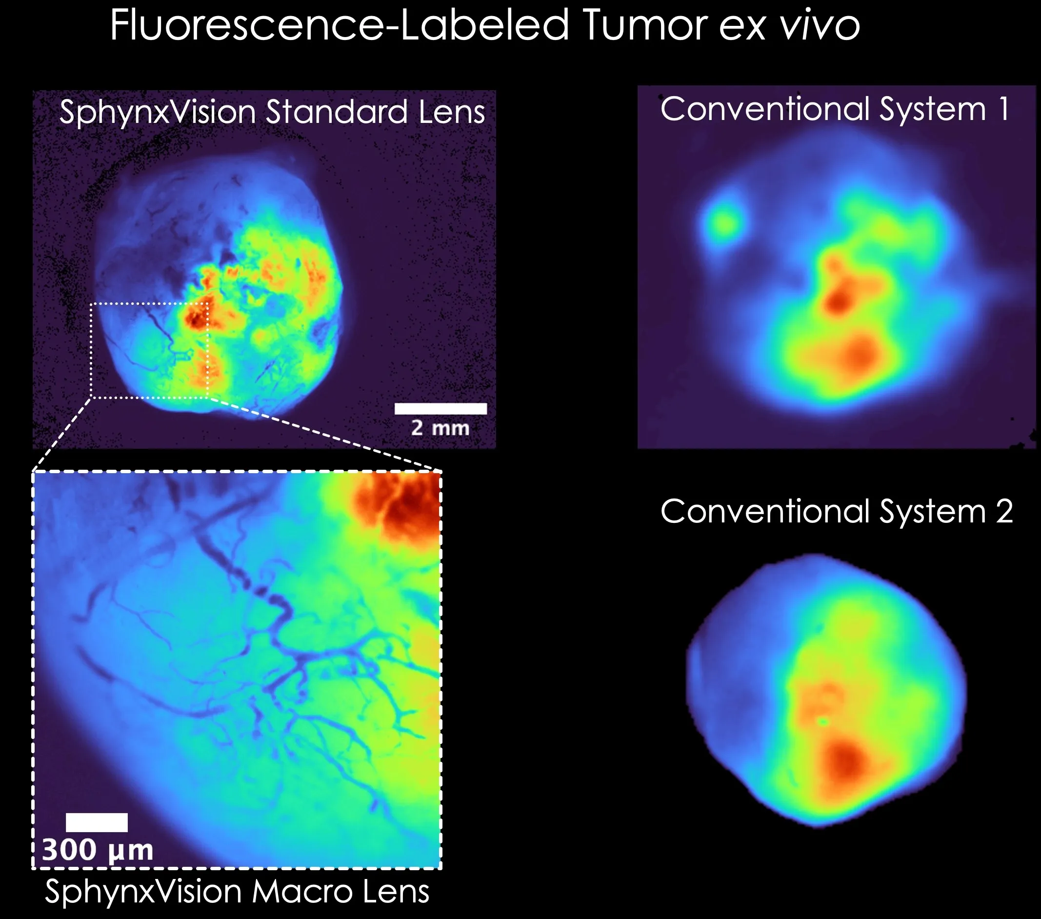 OncoBLAZE, an Innosphere Life Sciences Company, Introduces SphynxVision, a Portable Fluorescence Imaging System Designed to Help Researchers See Biology in Real Time