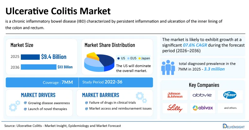 Ulcerative Colitis Market Outlook: 5 Late-Stage Drug Candidates to Watch | DelveInsight