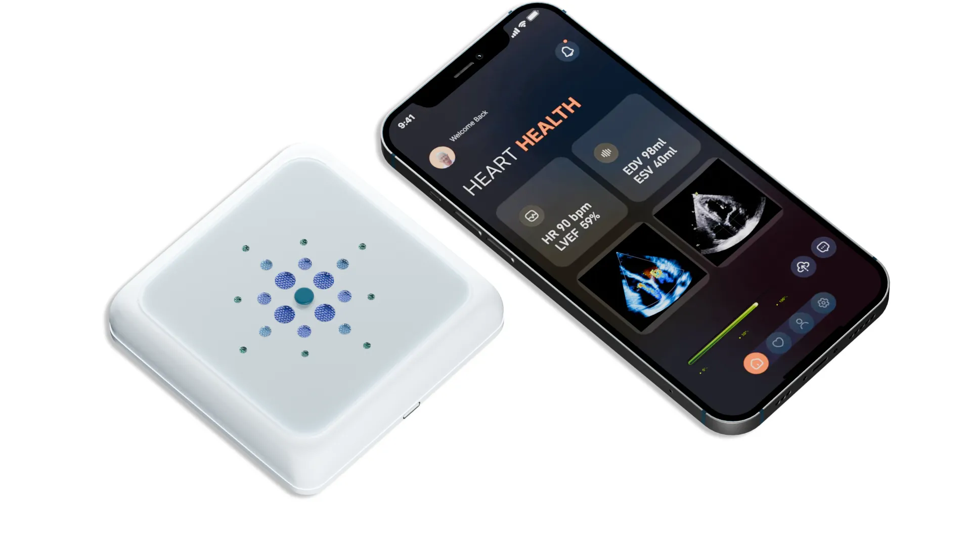 Sonus Microsystems and Medtronic Partner to Advance AI-Powered Maternal Health Monitoring
