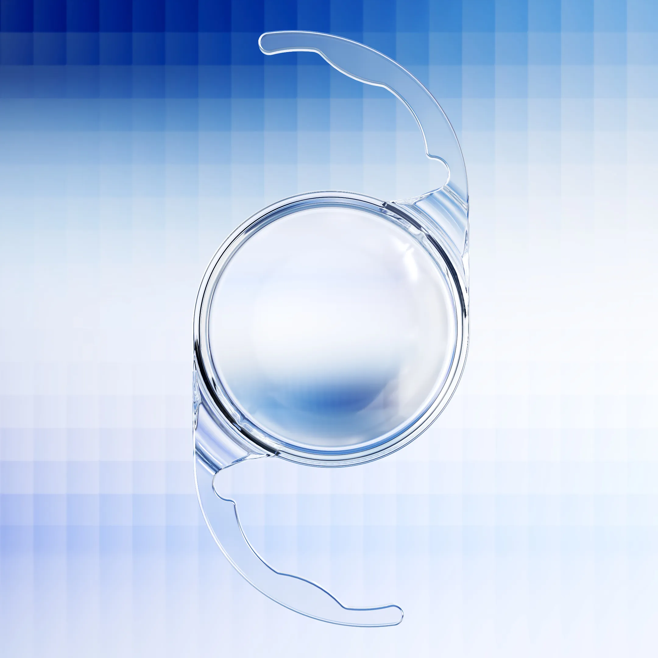 ZEISS announces availability of CT LUCIA 621P in Japan, expanding its broad ZEISS Cataract Workflow